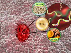 Vi khuẩn HP - Thủ phạm gây 90% các ca viêm loét dạ dày